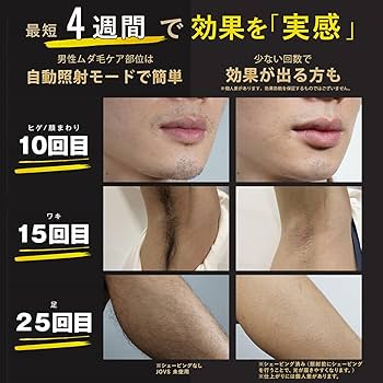 Amazon | JOVS Dora SRモード搭載 脱毛器 家庭用 光美容器 VIO対応 だ