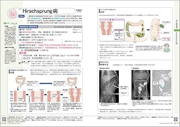 病気がみえる vol.15 小児科 第1版 | 医療情報科学研究所 |本 | 通販