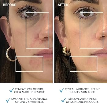 Amazon.com: FOREO LUNA 3 Facial Cleansing Brush | Combination skin