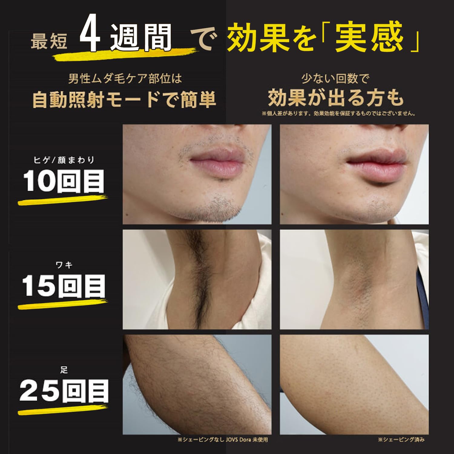 Amazon | JOVS Dora SRモード搭載 2024年型 脱毛器 家庭用 メンズ髭