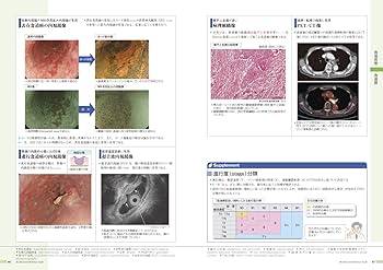 病気がみえる 〈vol.1〉 消化器 | 医療情報科学研究所 |本 | 通販 | Amazon