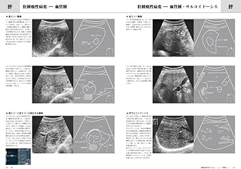 71Txuk-Bp6L._AC_UF350,