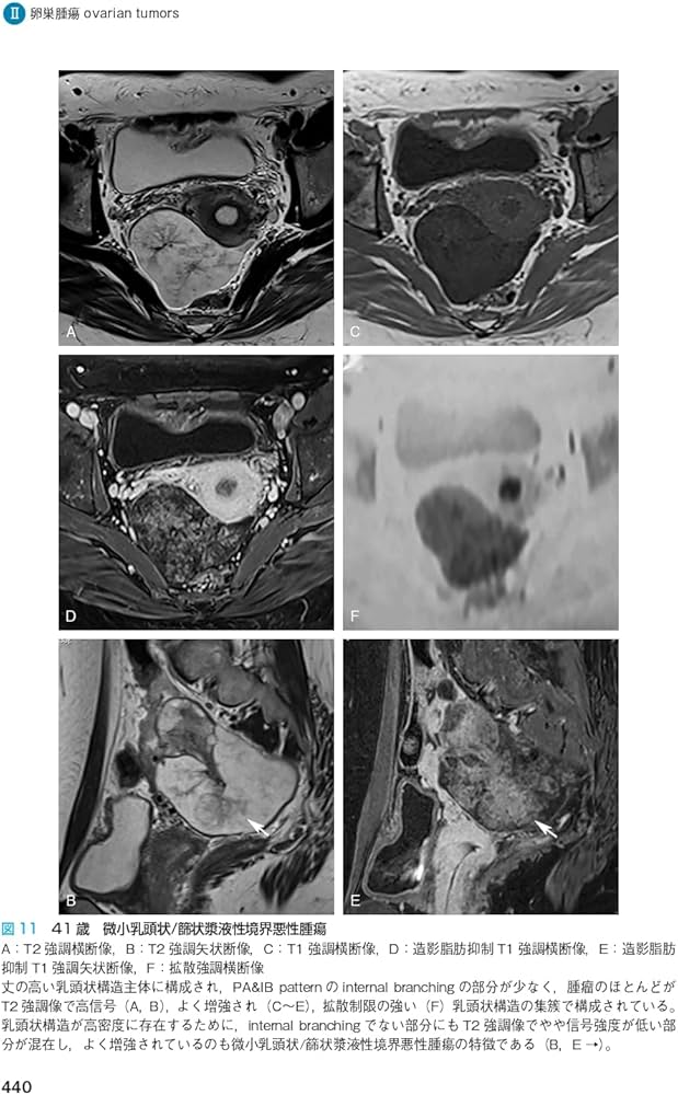 産婦人科の画像診断 第2版 | 田中 優美子 |本 | 通販 | Amazon