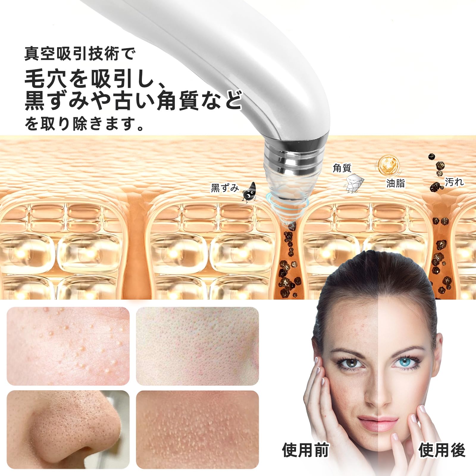 Amazon.co.jp: 【2024年新登場 カメラ付き】GUPAY 毛穴吸引器 カメラ