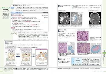 病気がみえる vol.7 脳・神経 第2版 | 医療情報科学研究所 |本 | 通販