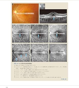 カラーアトラス眼底図譜 | 湯澤美都子, 川村昭之, 森隆三郎 |本 | 通販
