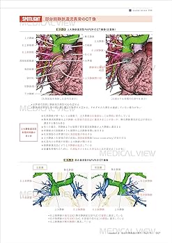 先天性心疾患の外科治療［Web動画付］−形態の理解と最良の三次元的再
