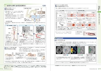 Amazon.co.jp: 病気がみえる vol.7 脳・神経 第2版 : 医療情報科学研究