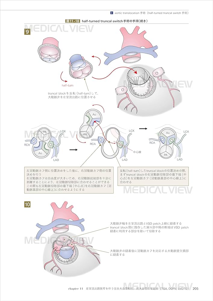 Amazon.co.jp: 先天性心疾患の外科治療［Web動画付］−形態の理解と