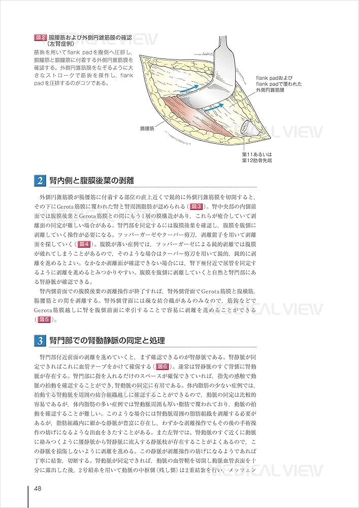 オープンサージャリ一 (Urologic Surgery Next 4) | 土谷 順彦 |本