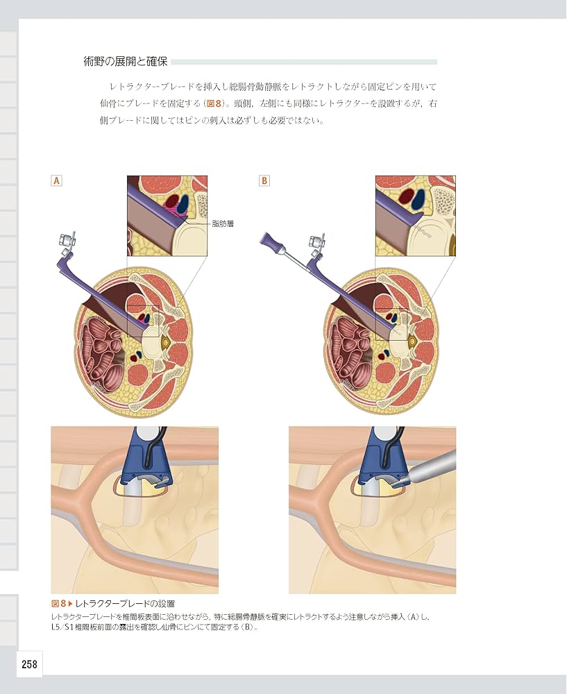 整形外科医のための脊椎のアドバンスト手術 | 石井 賢 |本 | 通販 | Amazon