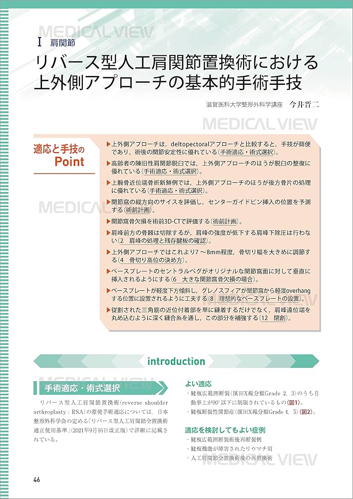 上肢の人工関節手術［Web動画付］ (新OS NEXUS No.5) | 今井 晋二 |本