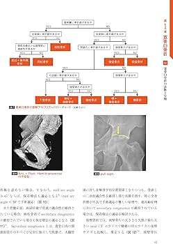 骨盤骨折: 寛骨臼骨折・骨盤輪骨折の手術手技 (整形外科SURGICAL