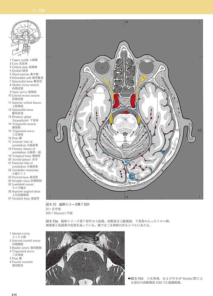 脳の機能解剖と画像診断 第2版 | 眞柳 佳昭 |本 | 通販 | Amazon