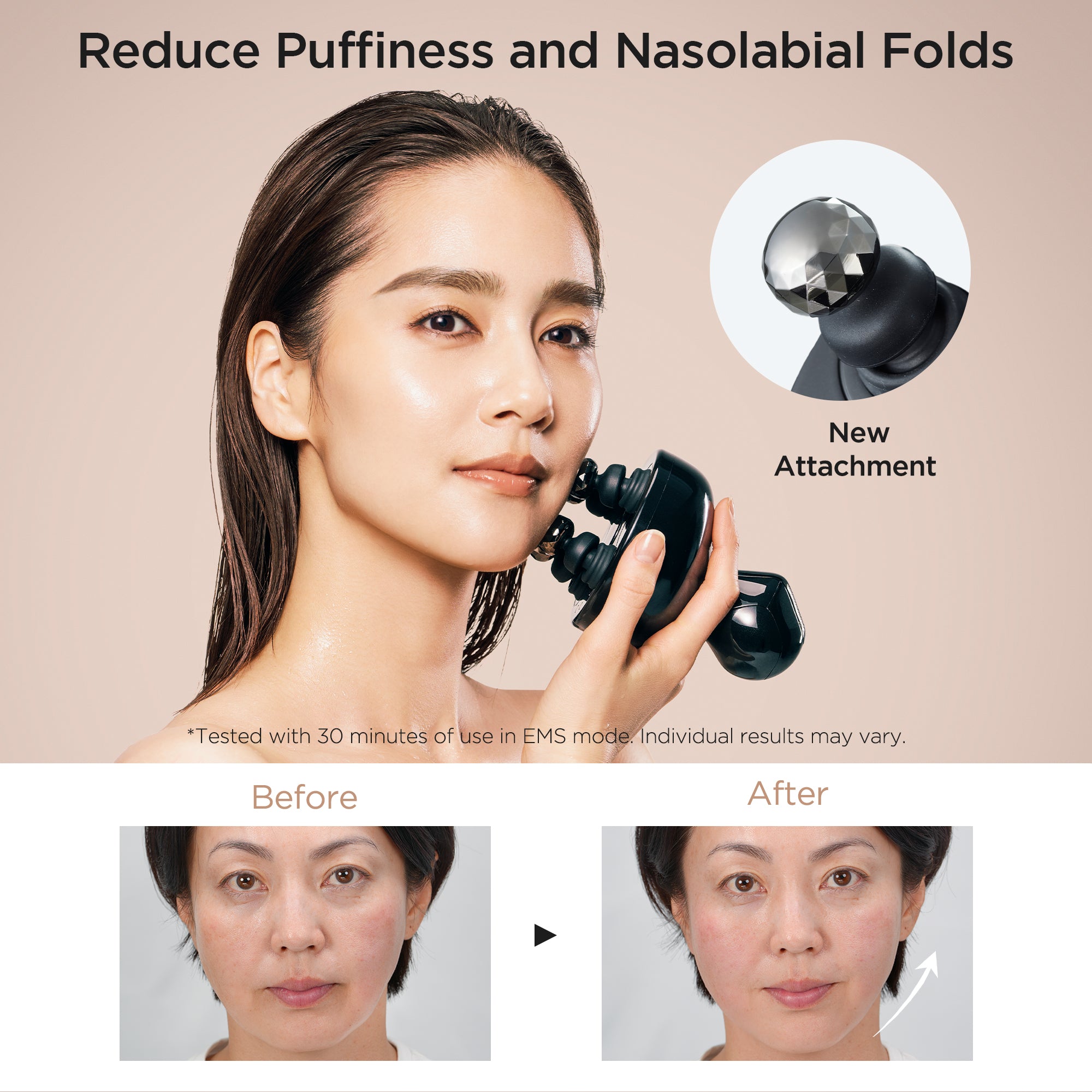 Head Spa Deep X Scalp Massager – MYTREX Global