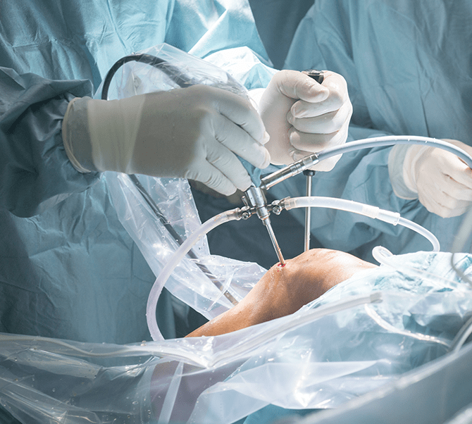 関節鏡・スポーツ医学センター | 大阪整形外科病院｜人工関節手術