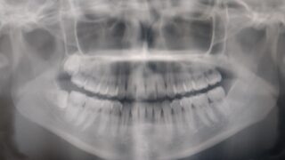 af09bd583553fed7c891a1d94ea498