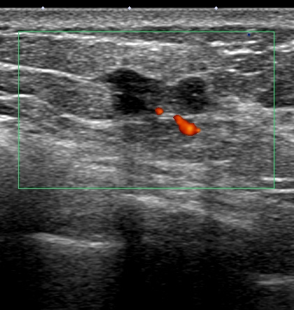 今週のコラム 495回目 癌の経過観察をされないために | 乳がんプラザ