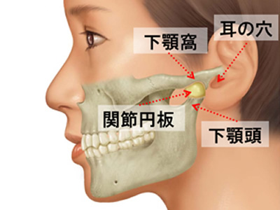 顎関節症の治療 | 桜川市で痛みに配慮したインプラント・歯医者なら