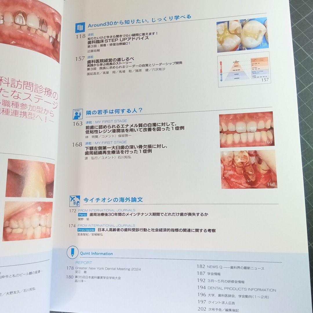 クインテッセンス 2025年3月号 オベイト型ポンティック製作 - メルカリ