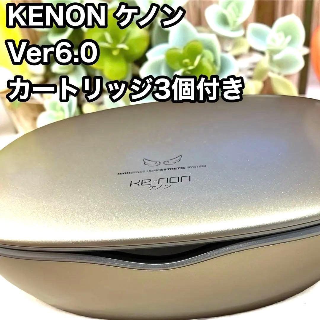 ケノン Ver.6.0 脱毛器 ゴールド 3個ヘッド付き Amazon | エムテック ケノン KE-NON 光美容器 日本製 髭 VIO対応