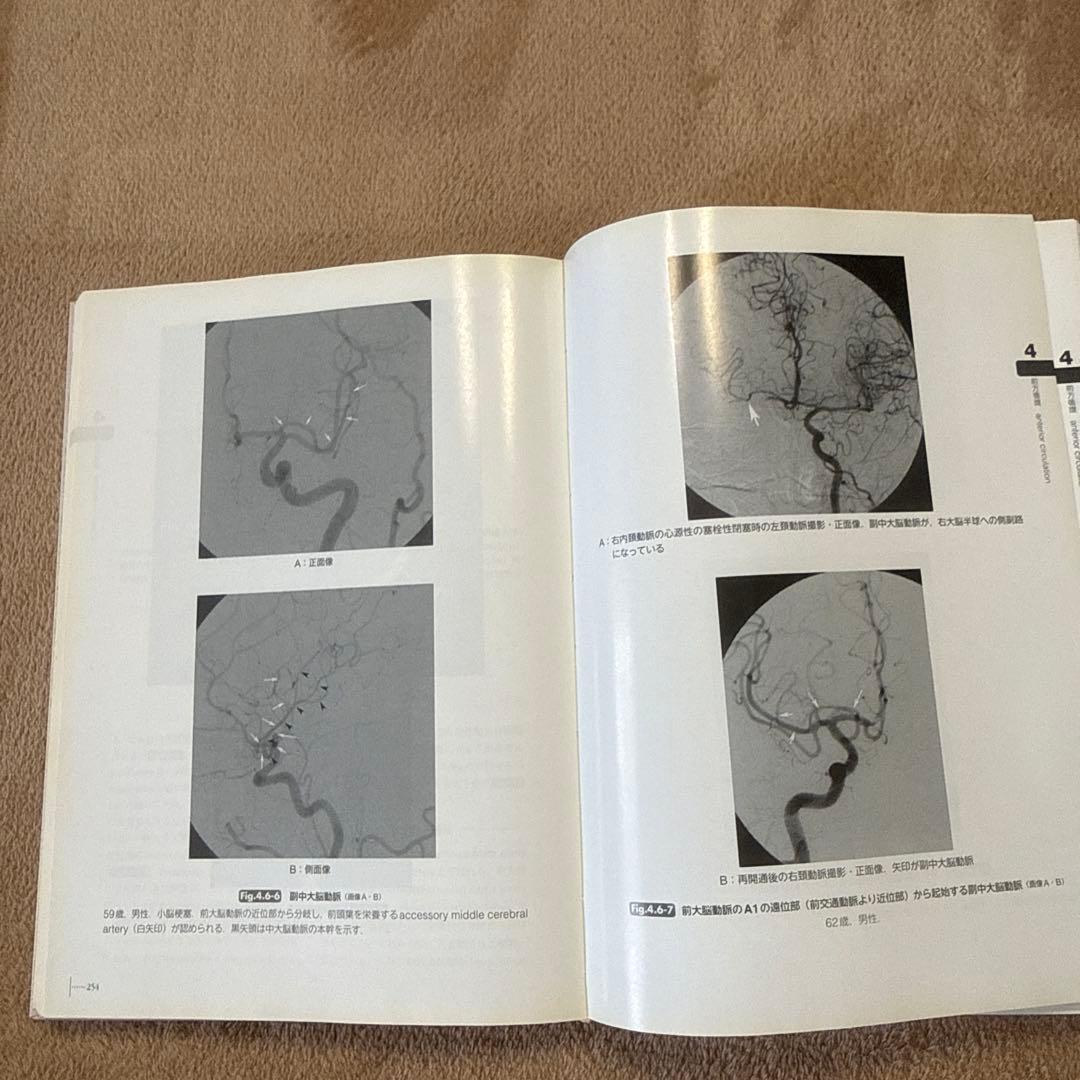 医学書 脳脊髄血管の機能解剖 増補版