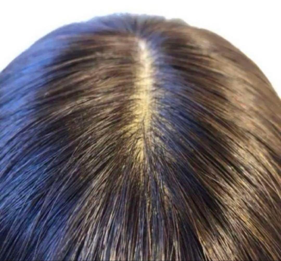 46cm 医療用レミー 人毛100% 総手植え サラサラロングヘア✨ 総手植え 最高級レミー人毛100% リアルフィットスキン トップ