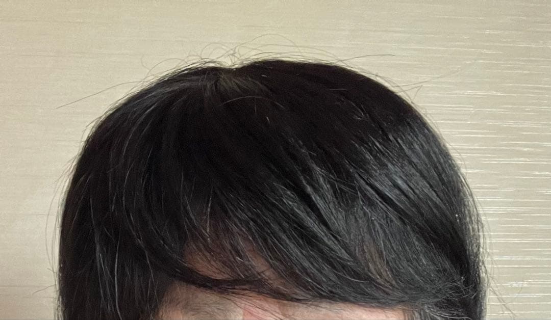 WIG YUKI ウィッグユキ/エアーすけすけピース/Mサイズ/人毛ミックス