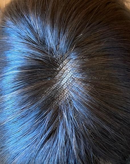 フォンテーヌ 六分(部分)ウィッグ 広範囲カバー VALAN demi VD02