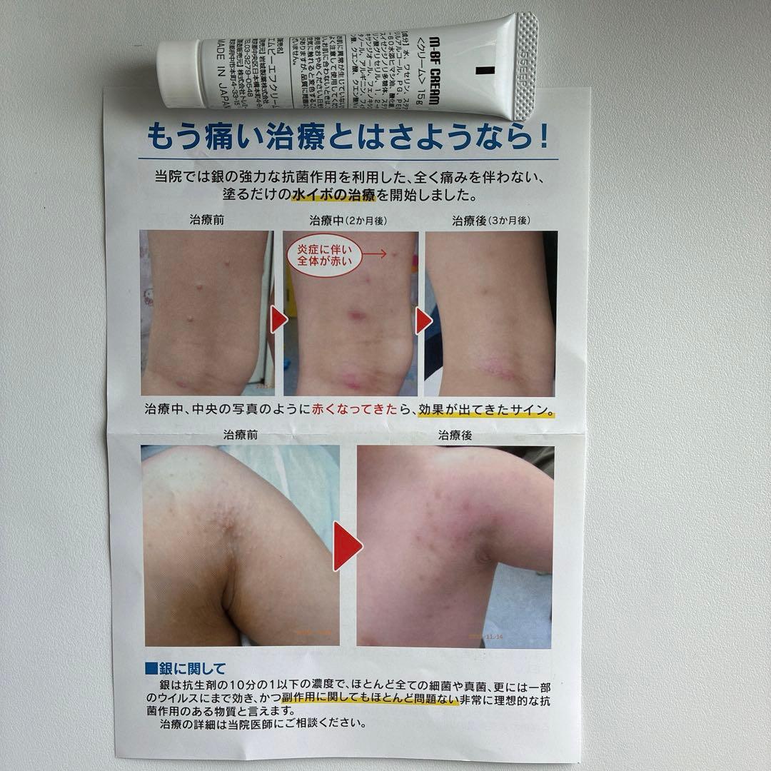 新品未使用 M-BFクリーム mbfクリーム 水いぼ - メルカリ